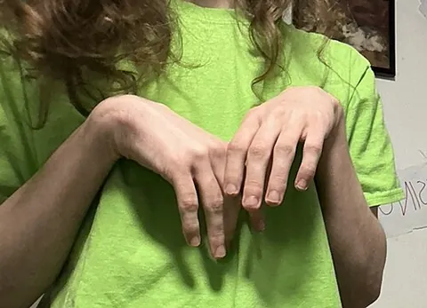 t. rex hands: a posture in which the arms are kept close to the body with the elbows bent perpendicularly;...