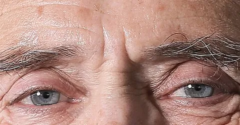 11 lines: vertical lines that appear between the eyebrows