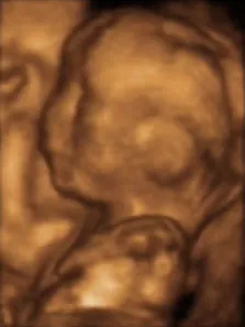 3d ultrasound: a medical ultrasound technique, used, for example, during pregnancy, providing...