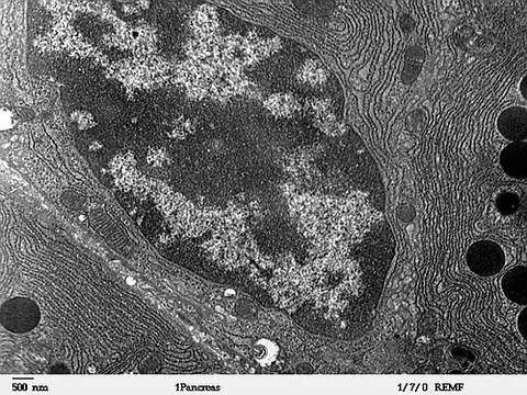 acinar: of, pertaining to, or located in an acinus