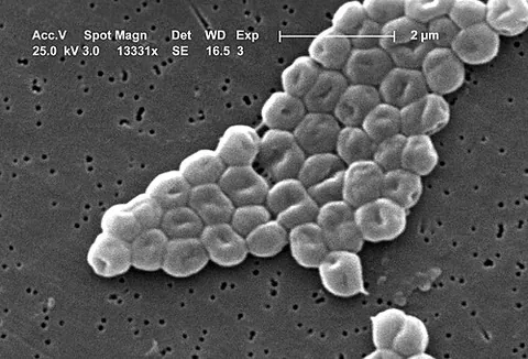 acinetobacter: any bacterium of the genus Acinetobacter