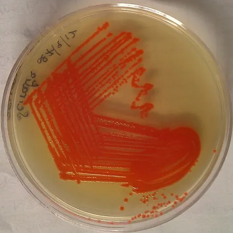 agar: a gelatinous substance obtained from red algae, especially Gracilaria species, used as a bacterial...