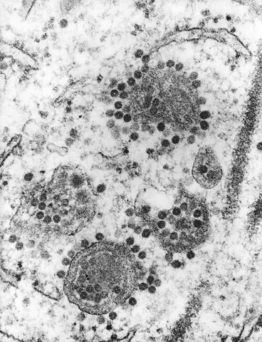 alphavirus: any virus of the genus Alphavirus (family Togaviridae)
