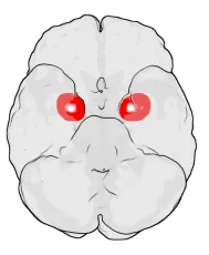 amygdala: each one of the two regions of the brain, located as a pair in the medial temporal lobe, believed...
