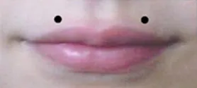 angel bites: a pair of lip piercings, like snakebites but above the lips rather than below
