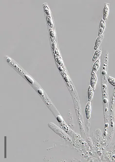 ascus: a sac-shaped cell present in ascomycete fungi; it is a reproductive cell in which meiosis and an...