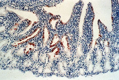 avulavirus: any member of the genus Avulavirus of viruses that infect birds