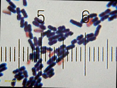 bacillus: any of various rod-shaped, spore-forming aerobic bacteria in the genus Bacillus, some of which...