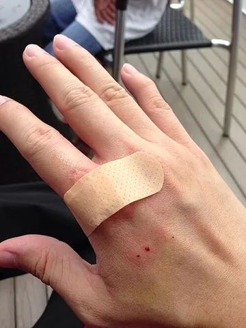 bandage: a strip of gauze or similar material used to protect or support a wound or injury