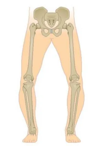 bandy-legged: synonym of bow-legged, having knees which bend outward