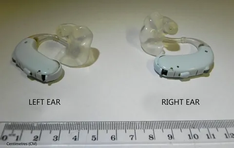 behind the ear: describing a type of hearing aid with microphone, amplifier, and battery that sit in a unit behind...