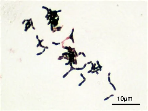 bifidobacterium: any bacterium of the genus Bifidobacterium