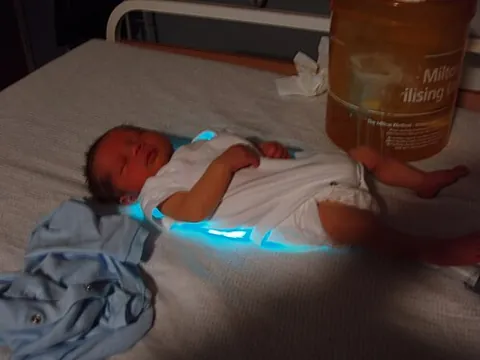 biliblanket: any of various light-emitting blankets that are used for home treatment of jaundice in infants
