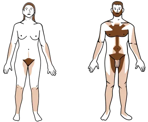 body hair: hair of the body; in particular, androgenic hair, to the exclusion of facial hair and the hair atop...