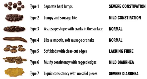 bristol stool chart: a chart (and associated scale) that classifies human faeces, with limited use as a diagnostic aid