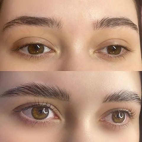 brow job: a plastic surgical procedure to alter the appearance of the browline or eyebrow(s), especially for...