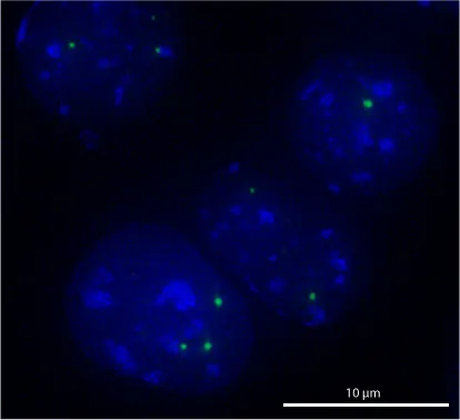 cajal body: a spherical membraneless nuclear body largely consisting of proteins and RNA, found in the nucleus...