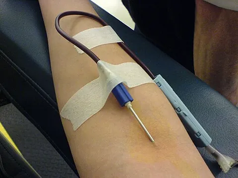 cannulize: synonym of cannulate (“to insert a cannula (“tube to drain or inject fluid”) into (a body part such...