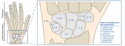carpal bone: any of the eight bones of the carpus or wrist: those being the scaphoid, lunate, triquetral,...