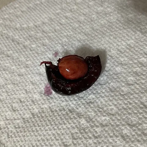 cherry pit: the stone of a cherry