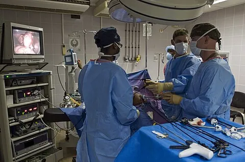 cholecystectomy: the surgical procedure to remove the gall bladder