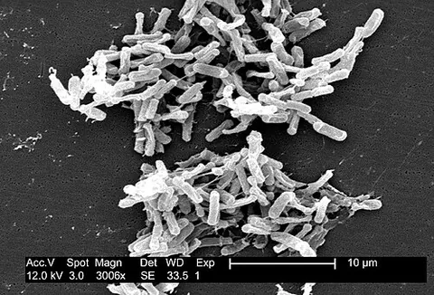 clostridium: any of several mostly anaerobic gram-positive bacteria, of the genus Clostridium, that are present...