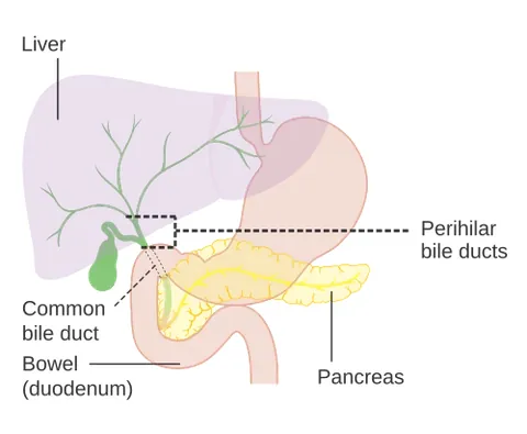 common bile duct: the bile duct downstream of the confluence of the common hepatic duct and the cystic duct, which...