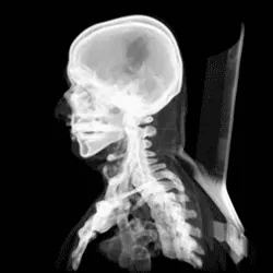 computed tomography: such imaging applied to health care