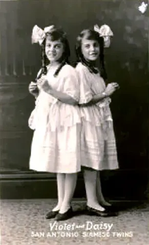 conjoined: of persons (conjoined twins) or things: joined together physically