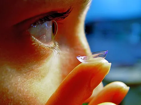 contact lens: a thin lens, made of flexible or rigid plastic, that is placed directly on to the eye to correct...