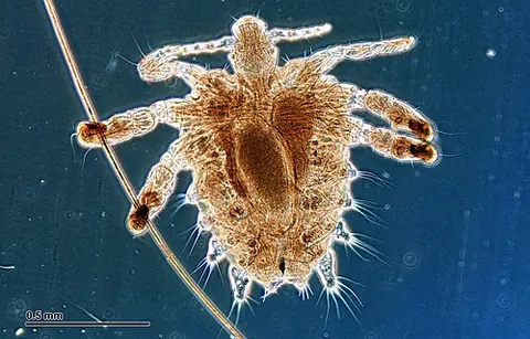 crab louse: a parasitic insect, Pthirus pubis, that lives amongst the pubic hairs of humans and feeds on blood