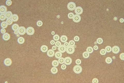 cryptococcus: any soil fungus of the genus Cryptococcus, some of which are pathogenic