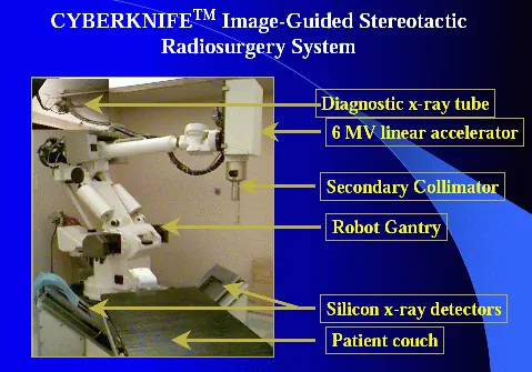 cyberknife: a robotic arm that performs radiosurgery (surgery using ionizing radiation), typically to remove a...