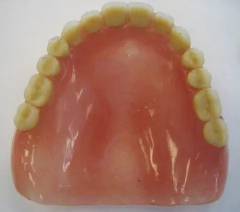 denture: a set of teeth, the teeth viewed as a unit