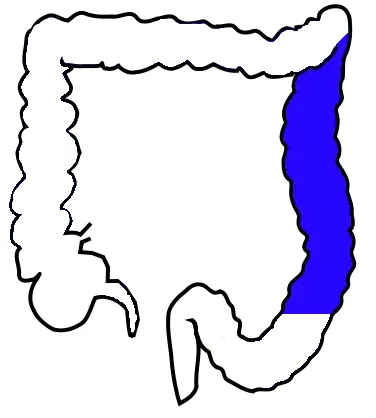 descending colon: a part of the colon adjacent to the sigmoid colon