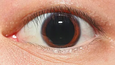 dilate: to enlarge; to make bigger