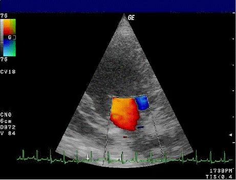 doppler ultrasonography: any of various types of ultrasonography that use the Doppler effect