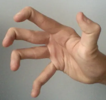 double-jointed: having one or more joints (usually those of the fingers, arms, or legs) able to bend more than is...