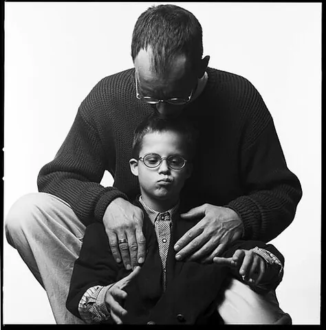 down syndrome: a genetic disorder caused by the presence of all or part of a third copy of chromosome 21 (a...