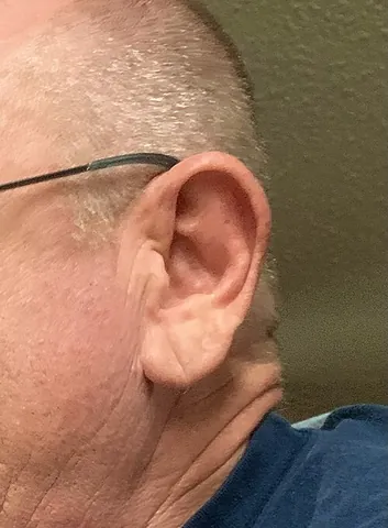 ear lobe: the lower, exterior, fleshy, bulbous part of the human ear