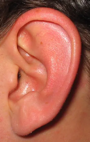 ear: the organ of hearing, consisting of the pinna or auricle, auditory canal, eardrum, malleus, incus,...