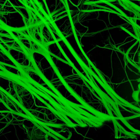 elastic fiber: any of the extracellular yellowish fibers, composed primarily of elastin, which provide elasticity...