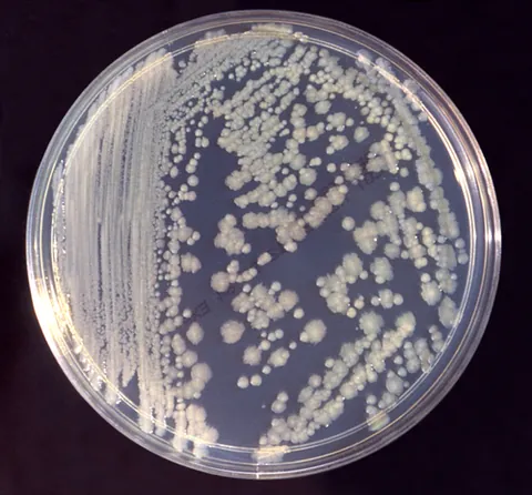 enterobacter: any bacterium of the genus Enterobacter