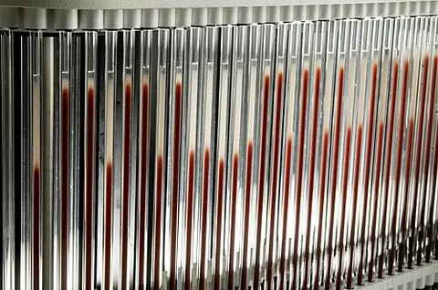erythrocyte sedimentation rate: the rate (usually expressed in millimeters per hour) at which red blood cells precipitate in a...