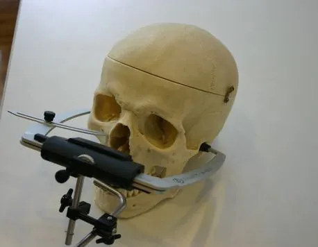 facebow: a prosthodontic instrument used to transfer functional and aesthetic components from the patient's...