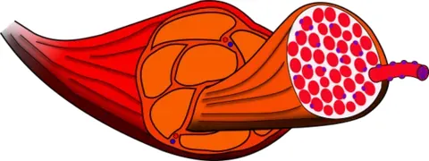 fascicle: a bundle or cluster