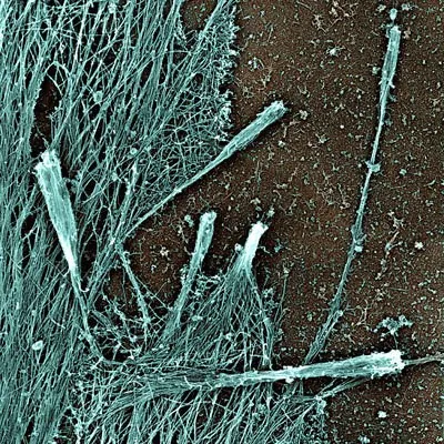 filopodium: a slender cytoplasmic projection which extends from the leading edge of a migrating cell