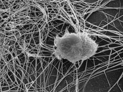 follicular dendritic cell: a specific type of cell, found in lymphoid follicles having filiform dendrites that bind and...