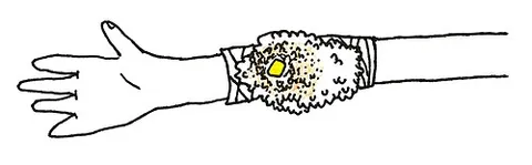 fomentation: the act of fomenting; the application of warm, soft, medicinal substances, as for the purpose of...