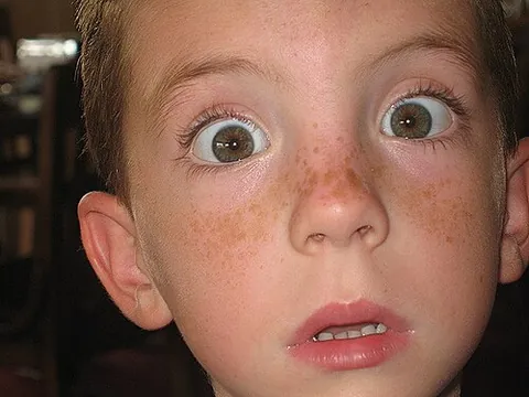 freck: synonym of freckle (“a small brownish or reddish pigmentation spot on the surface of the skin; any...
